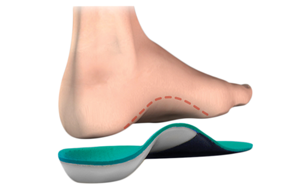 5 Ways Custom Orthotics Can Change Your Life for The Better