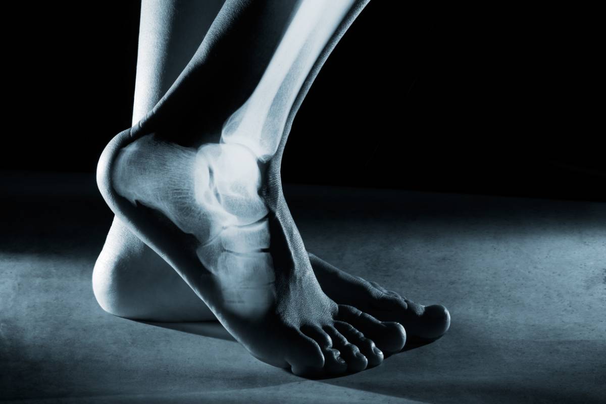 How to wear High Heels? - Consultant Orthopaedics Edinburgh Mr.Shalaby